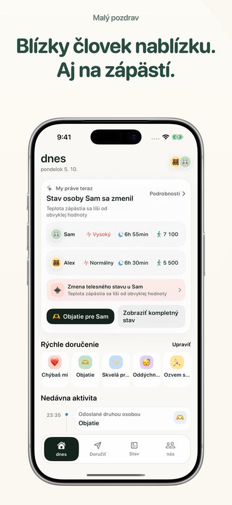 Malý pozdrav - Apple Watch · Bližší pohľad 1